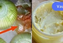 ხახვის ქერქი არასოდეს გადაყაროთ!ხახვის ქერქის 6 უჩვეულო გამოყენება.