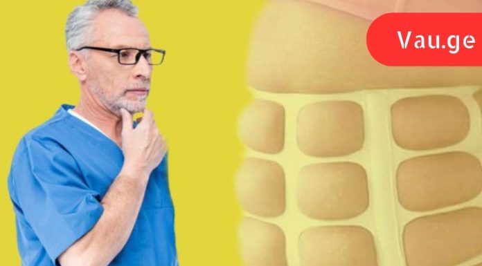 მარტივი და სწრაფი გზა მუცლისა და გვერდების მოსაშორებლად! ამ საუკეთესო ექიმის წყალობით დავემშვიდობე ჭარბ წონას