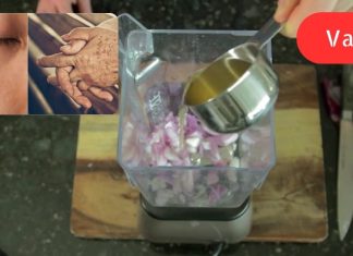 ამერიკელმა ექიმმა მოგვაწოდა ინფორმაცია! ამ ორი ნივთიერების საშუალება ძალიან სწრაფად ათეთრებს ასაკობრივ ლაქებს.