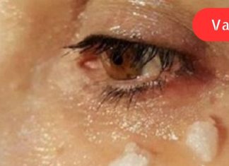 რა მოხდება 5 წუთის შემდეგ, თუ ქოქოსის ზეთს თვალის მიდამოში წაისვით?