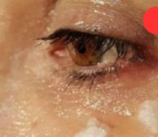 რა მოხდება 5 წუთის შემდეგ, თუ ქოქოსის ზეთს თვალის მიდამოში წაისვით?