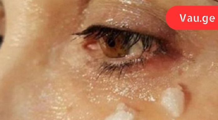 რა მოხდება 5 წუთის შემდეგ, თუ ქოქოსის ზეთს თვალის მიდამოში წაისვით?