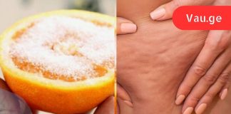 „ცელულიტი საბოლოოდ დამარცხებულია! იმისთვის, რომ ძველი ცელულიტი და სტრიები გაქრეს, უბრალოდ შეიზილეთ…”