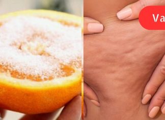 „ცელულიტი საბოლოოდ დამარცხებულია! იმისთვის, რომ ძველი ცელულიტი და სტრიები გაქრეს, უბრალოდ შეიზილეთ…”