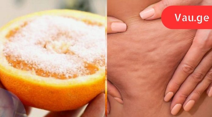 „ცელულიტი საბოლოოდ დამარცხებულია! იმისთვის, რომ ძველი ცელულიტი და სტრიები გაქრეს, უბრალოდ შეიზილეთ…”