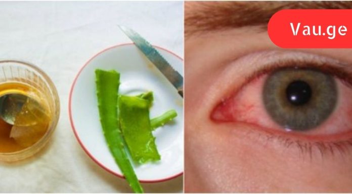 დაემშვიდობე სათვალეს! ამ საშუალების წყალობით მხედველობა დაიბრუნებ 3 თვის შემდეგ.