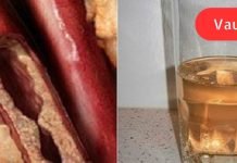 როგორ გავწმინდოთ არტერიები ერთ თვეში: სასმელი, რომელიც უზრუნველყოფს გულს საიმედო დაცვას.