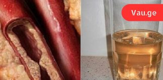 როგორ გავწმინდოთ არტერიები ერთ თვეში: სასმელი, რომელიც უზრუნველყოფს გულს საიმედო დაცვას.