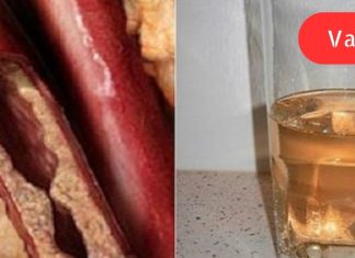 როგორ გავწმინდოთ არტერიები ერთ თვეში: სასმელი, რომელიც უზრუნველყოფს გულს საიმედო დაცვას.