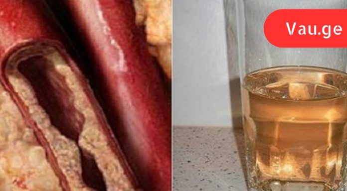 როგორ გავწმინდოთ არტერიები ერთ თვეში: სასმელი, რომელიც უზრუნველყოფს გულს საიმედო დაცვას.