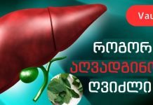 ღვიძლის გაწმენდა სახლის პირობებში შესაძლებელია პიტნა-ლიმონის სასმელის მარტივი რეცეპტის წყალობით!