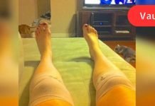 მან გაიკეთა ეს კომპრესი და მჭიდროდ შემოიხვია მუხლები! ერთი საათის შემდეგ მისი ცხოვრება შეიცვალა…