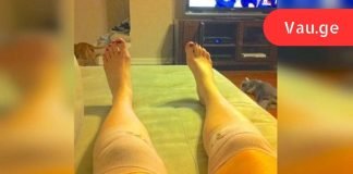 მან გაიკეთა ეს კომპრესი და მჭიდროდ შემოიხვია მუხლები! ერთი საათის შემდეგ მისი ცხოვრება შეიცვალა…