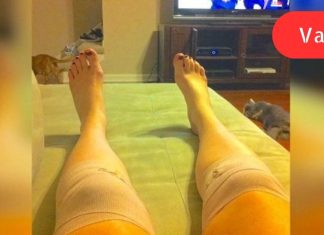 მან გაიკეთა ეს კომპრესი და მჭიდროდ შემოიხვია მუხლები! ერთი საათის შემდეგ მისი ცხოვრება შეიცვალა…