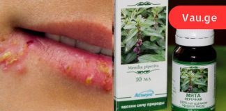 7 ხალხური მეთოდი, რომელიც დღის განმავლობაში ჰერპესის მოშორებაში დაგეხმარებათ!