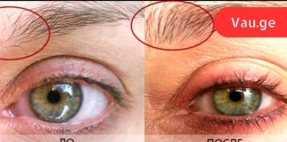 ლამაზი წარბები ყველა მოვლილი გოგოს დამახასიათებელი ნიშანია.ამიტომ ყოველ საღამოს ვიხეხავ წარბებს ლიმონის ნაჭერით!გასაოცარი ეფექტი…