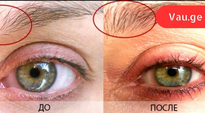 ლამაზი წარბები ყველა მოვლილი გოგოს დამახასიათებელი ნიშანია.ამიტომ ყოველ საღამოს ვიხეხავ წარბებს ლიმონის ნაჭერით!გასაოცარი ეფექტი…