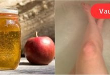 მან მიიღო აბაზანა და დაუმატა 500 მლ ვაშლის სიდრი ძმარი. 30 წუთის შემდეგ მისი კანი სასწაული იყო.