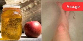 მან მიიღო აბაზანა და დაუმატა 500 მლ ვაშლის სიდრი ძმარი. 30 წუთის შემდეგ მისი კანი სასწაული იყო.