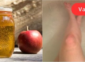 მან მიიღო აბაზანა და დაუმატა 500 მლ ვაშლის სიდრი ძმარი. 30 წუთის შემდეგ მისი კანი სასწაული იყო.