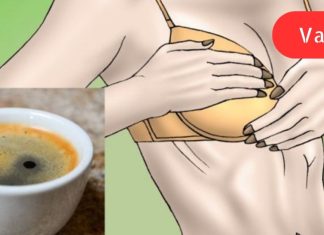 ეს ქალბატონი დღეში სამ ფინჯან ყავას სვამდა. რაც მის მკერდს დაემართა, ყველა შოკში ჩააგდო!