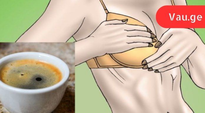 ეს ქალბატონი დღეში სამ ფინჯან ყავას სვამდა. რაც მის მკერდს დაემართა, ყველა შოკში ჩააგდო!