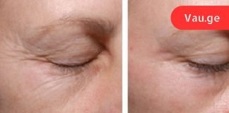 სახლში მომზადებული გელი თვალის ირგვლივ კანისთვის: ნატურალური ინგრედიენტები მოგაშორებთ ნაოჭებს!