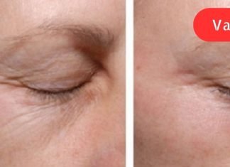 სახლში მომზადებული გელი თვალის ირგვლივ კანისთვის: ნატურალური ინგრედიენტები მოგაშორებთ ნაოჭებს!