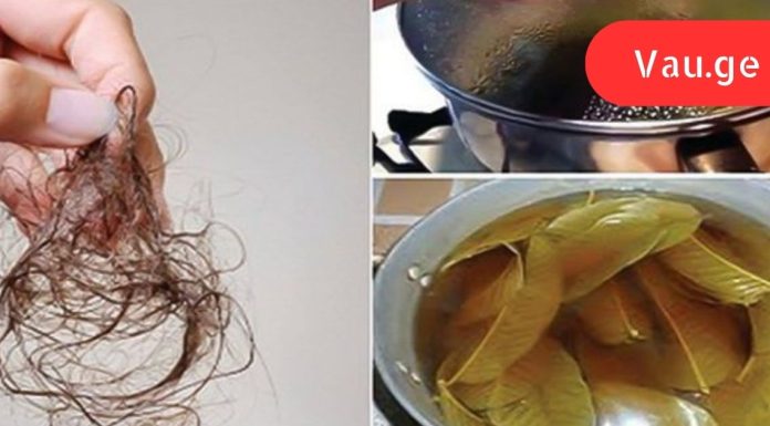 ეს უნდა იცოდე, როგორ შევაჩეროთ თმის ცვენა!