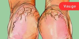 ამ კრემს ვერცერთ მაღაზიაში ვერ ნახავთ!