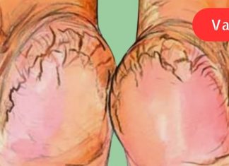 ამ კრემს ვერცერთ მაღაზიაში ვერ ნახავთ!