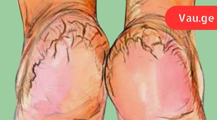 ამ კრემს ვერცერთ მაღაზიაში ვერ ნახავთ!