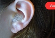 ამ საშუალების მხოლოდ 3 წვეთი, ჩაწვეთებული ყურში, იძლევა წარმოუდგენელ ეფექტს!