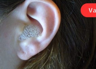 ამ საშუალების მხოლოდ 3 წვეთი, ჩაწვეთებული ყურში, იძლევა წარმოუდგენელ ეფექტს!