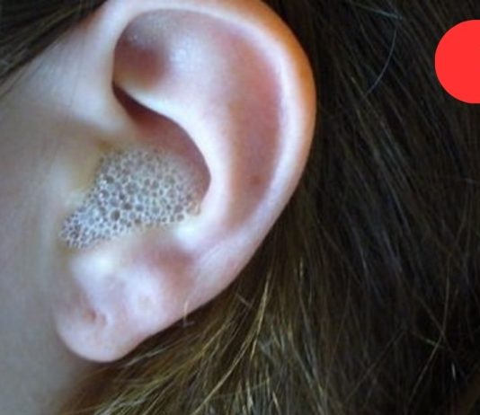 ამ საშუალების მხოლოდ 3 წვეთი, ჩაწვეთებული ყურში, იძლევა წარმოუდგენელ ეფექტს!