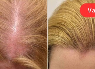 ამ ხრიკის წყალობით თმა ისე სწრაფად გამეზარდა ერთ თვეში თვალებს არ ვუჯერებდი