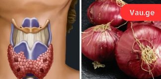 მან ყელზე ხახვის კომპრესი მოათავსა. ის, რაც რამდენიმე საათის შემდეგ მოხდა, საოცარია!