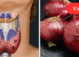 მან ყელზე ხახვის კომპრესი მოათავსა. ის, რაც რამდენიმე საათის შემდეგ მოხდა, საოცარია!