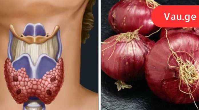 მან ყელზე ხახვის კომპრესი მოათავსა. ის, რაც რამდენიმე საათის შემდეგ მოხდა, საოცარია!