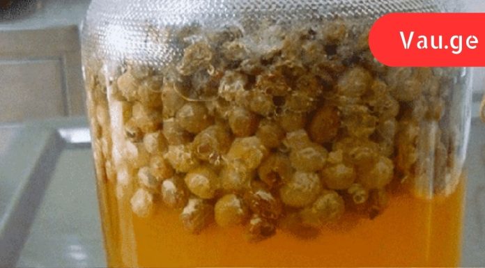 ღვიძლის ნაზი წმენდა 2 დღეში: ქიშმიში, წყალი და ეს ყველაფერი გვერდითი მოვლენების გარეშე!