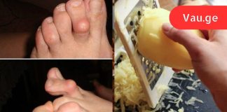 პირველადი დახმარების საშუალება რევმატოიდული ართრიტის დროს: ტკივილი გაქრა და ძვლები უფრო პატარაა!