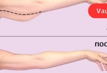 როგორ მოვიშოროთ ცხიმი ხელებიდან: 3 ეფექტური გზა.