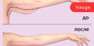 როგორ მოვიშოროთ ცხიმი ხელებიდან: 3 ეფექტური გზა.