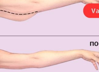 როგორ მოვიშოროთ ცხიმი ხელებიდან: 3 ეფექტური გზა.