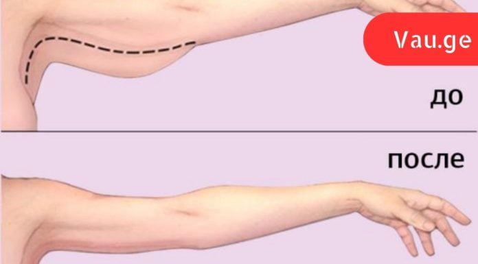 როგორ მოვიშოროთ ცხიმი ხელებიდან: 3 ეფექტური გზა.