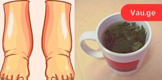 ეს არის ალბათ ყველაზე ძლიერი ბუნებრივი საშუალება შეშუპებული ფეხებისთვის!