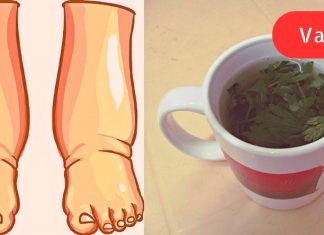 ეს არის ალბათ ყველაზე ძლიერი ბუნებრივი საშუალება შეშუპებული ფეხებისთვის!
