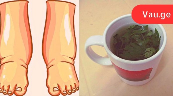 ეს არის ალბათ ყველაზე ძლიერი ბუნებრივი საშუალება შეშუპებული ფეხებისთვის!