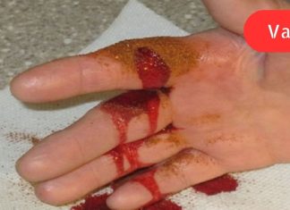 ხრიკი სისხლდენის შესაჩერებლად 10 წამში: უვნებელი მეთოდი!