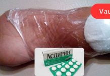 ამით თქვენ გათავისუფლდებით დაბზარული ქალუსებისგან სულ რაღაც 10 დღეში!